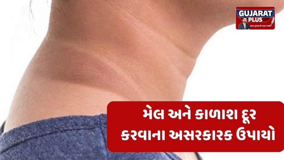 કાળી પડી ગયેલી ગરદનથી પરેશાન છો? કાળાશ દૂર કરવા અજમાવો આ 3 સરળ દેશી નુસખા